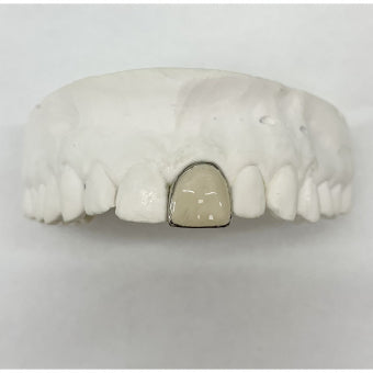 Opal Window Single Grillz