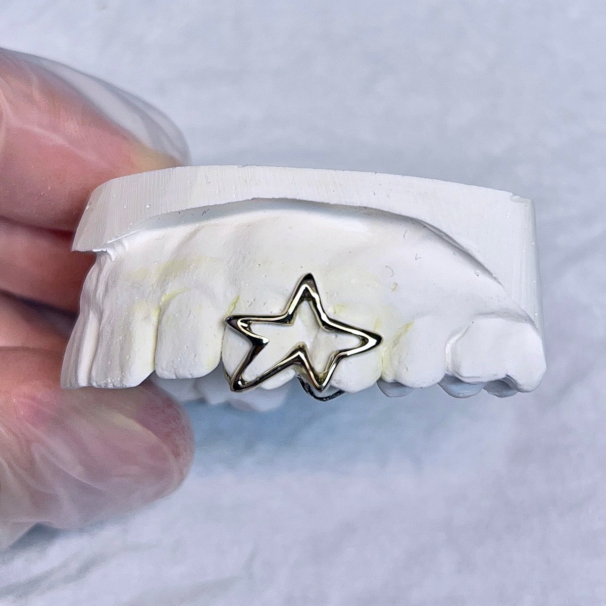 Custom Star grillz