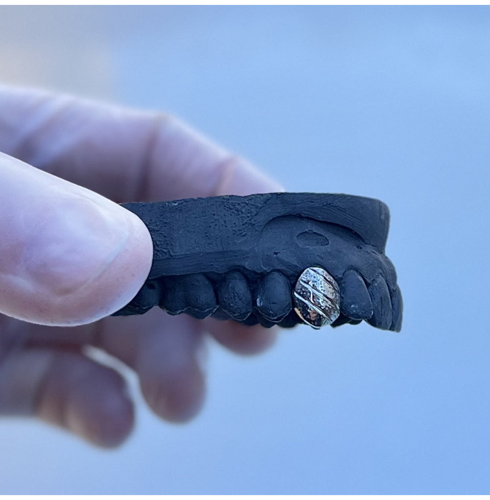 Diamond Cut with Dots Custom Grillz