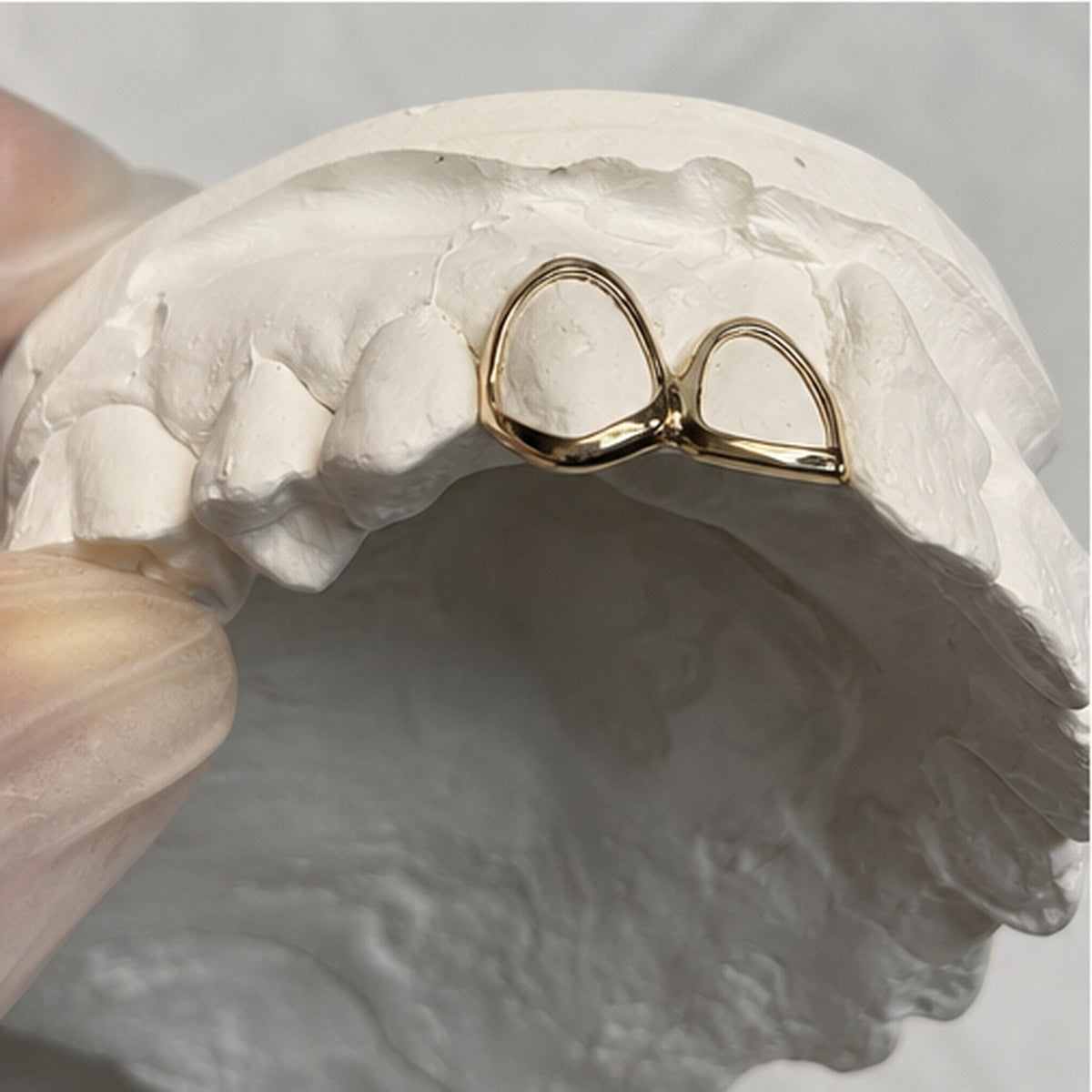 Bespoke Double Caps Grillz 