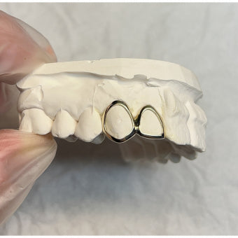 Custommade Double Caps Gold Grillz