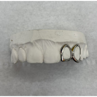 Custom grillz fitted on teeth