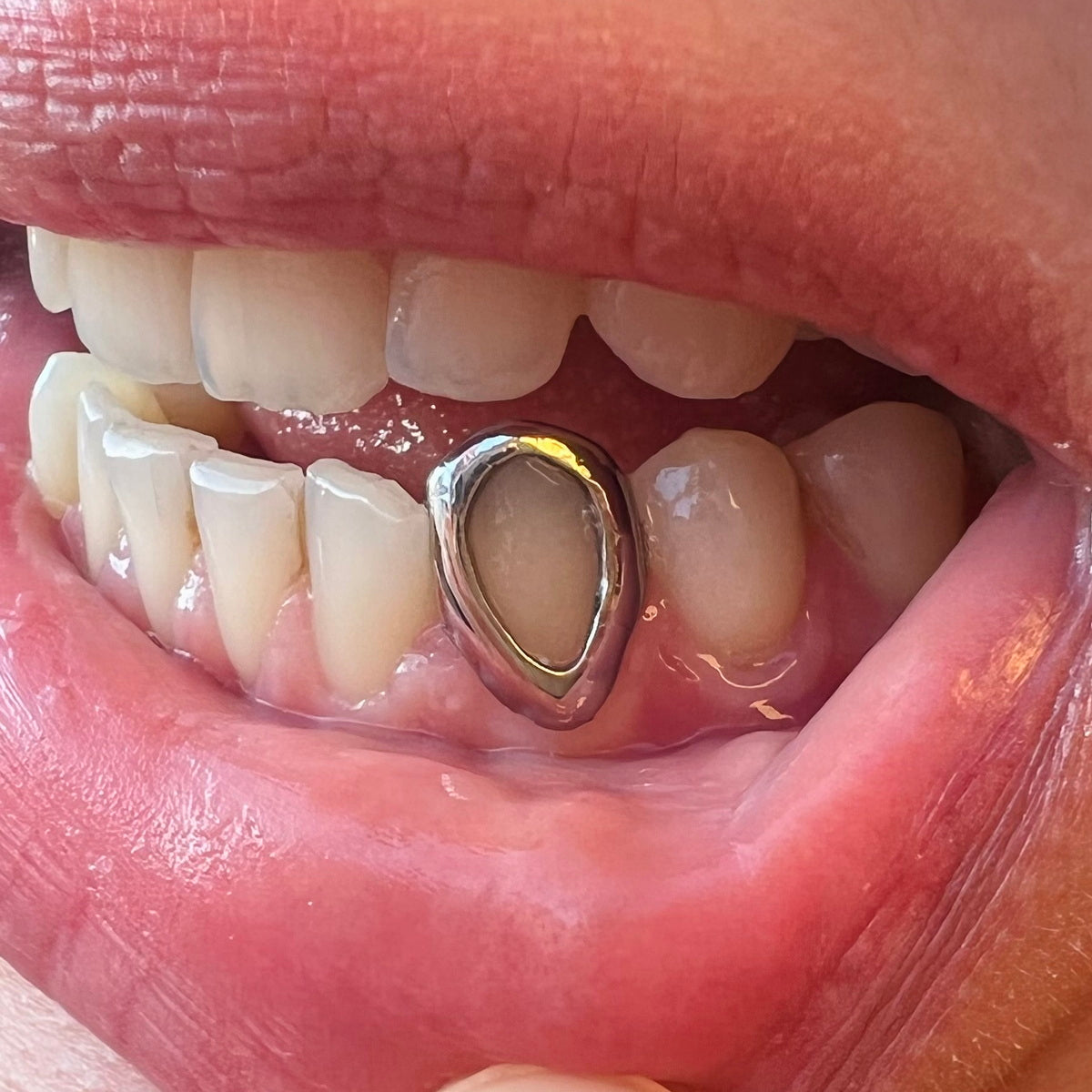 Custom Window Cap Grillz
