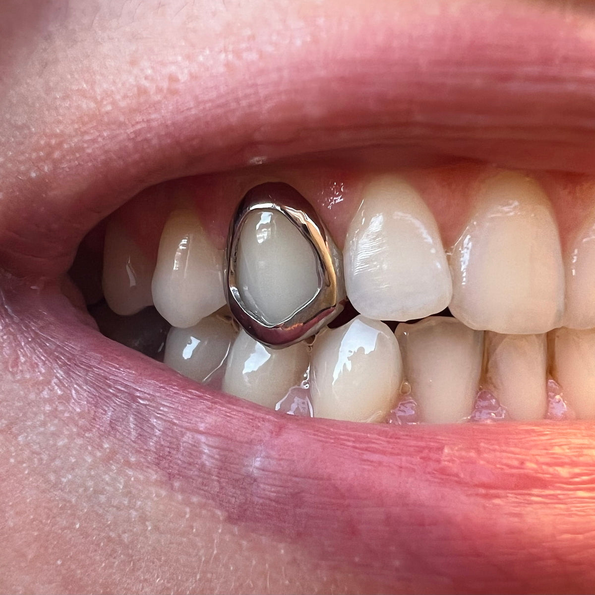 Custom Window Cap Grillz