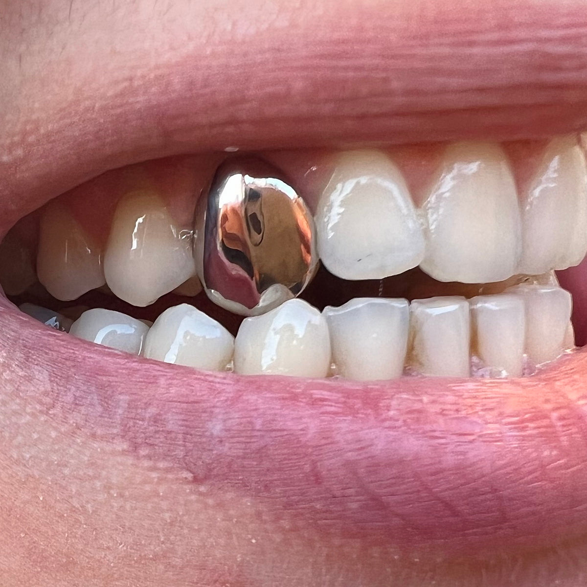 Custom Solid Cap Grillz