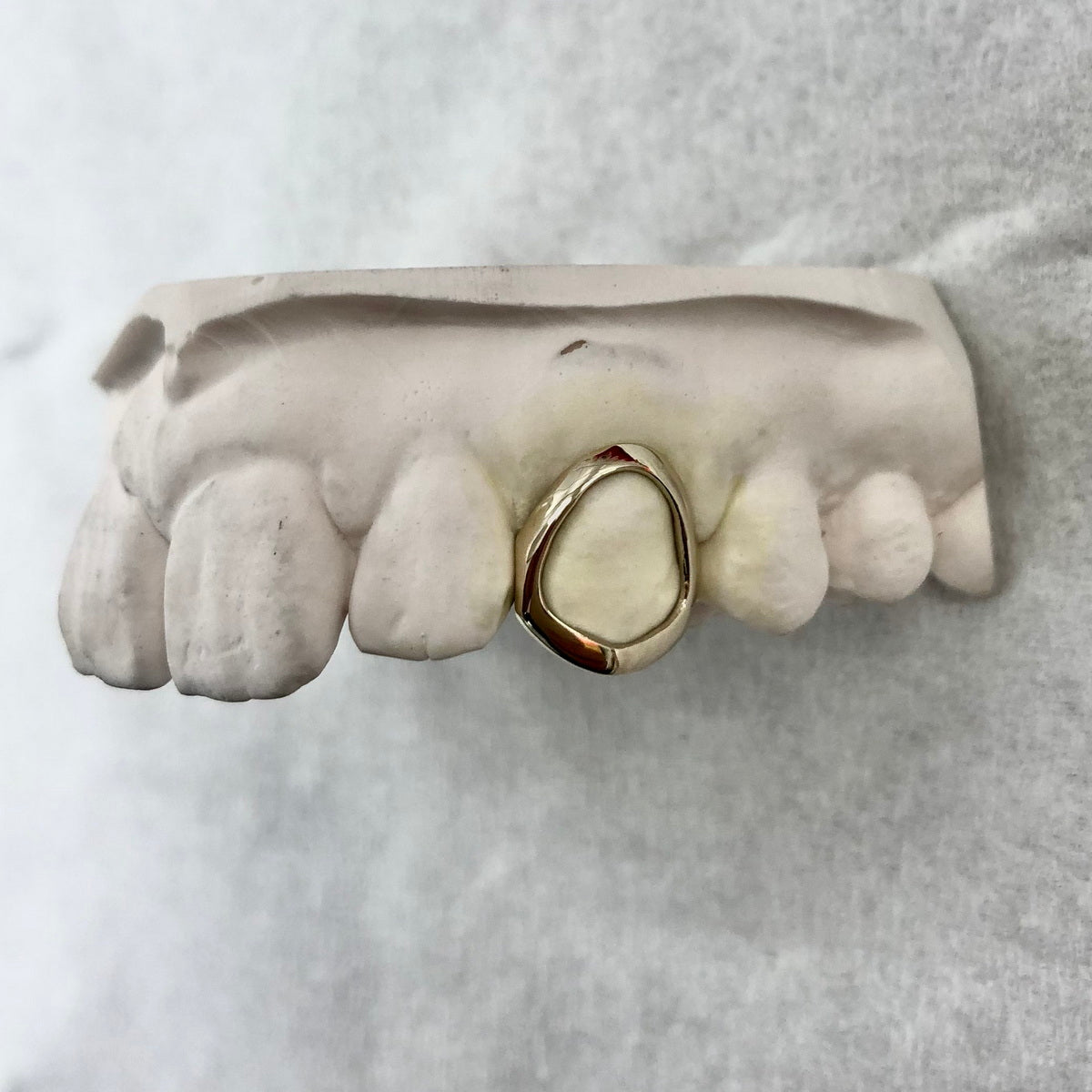 Custom Window Cap Grillz
