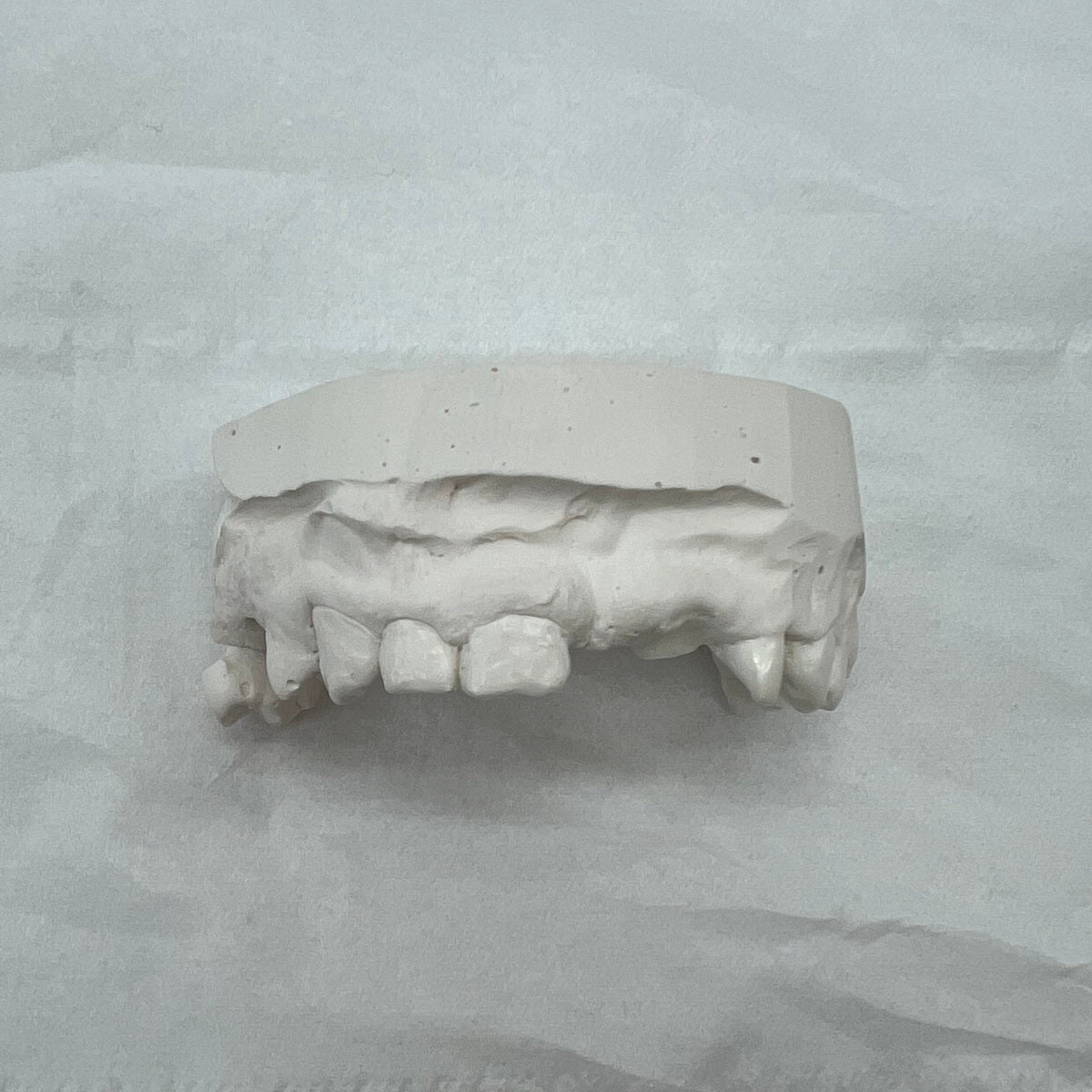 Custom Gapfiller Solid 6 Set Grillz