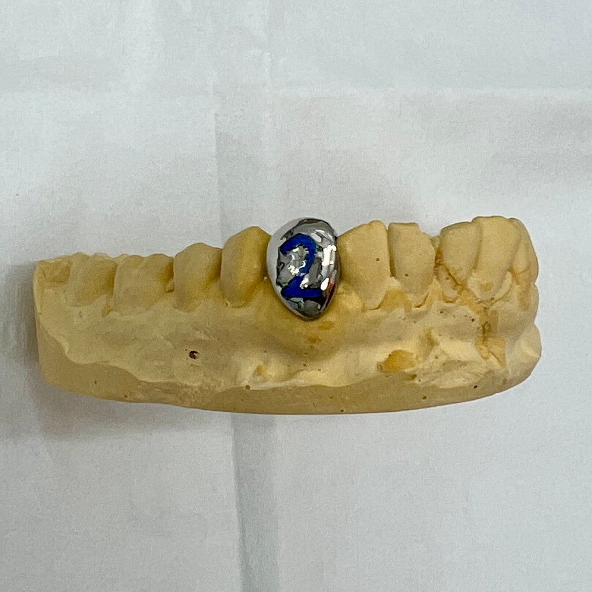 Fired Ceramic Custom Grillz