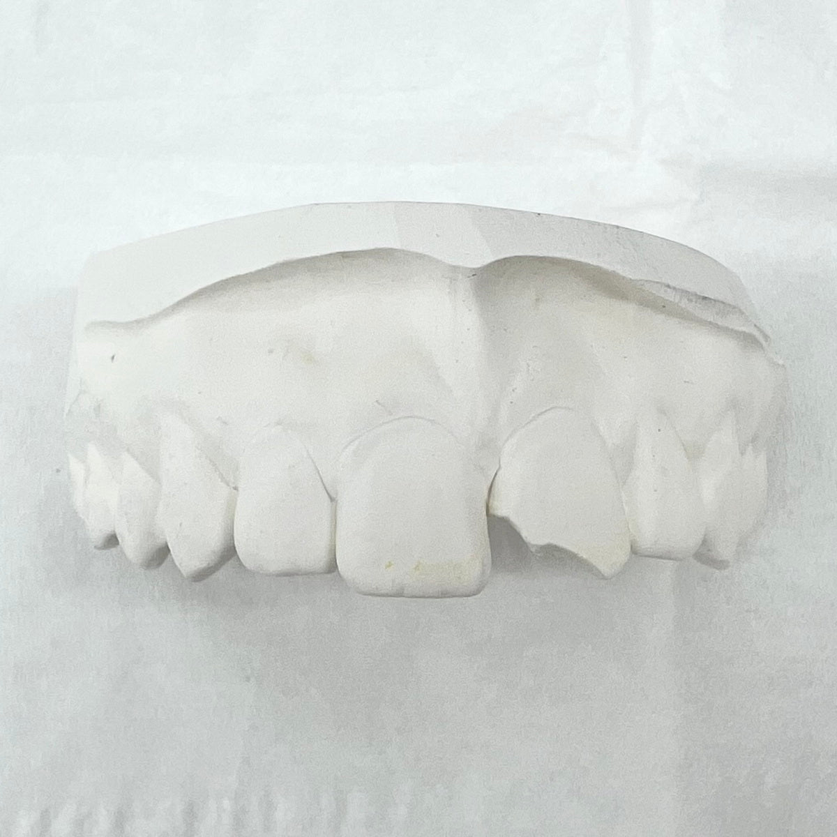 Broken Tooth Filler Custom Grillz