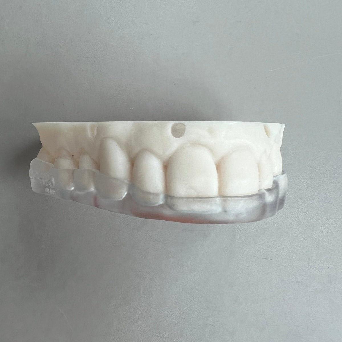 Michigan Splint