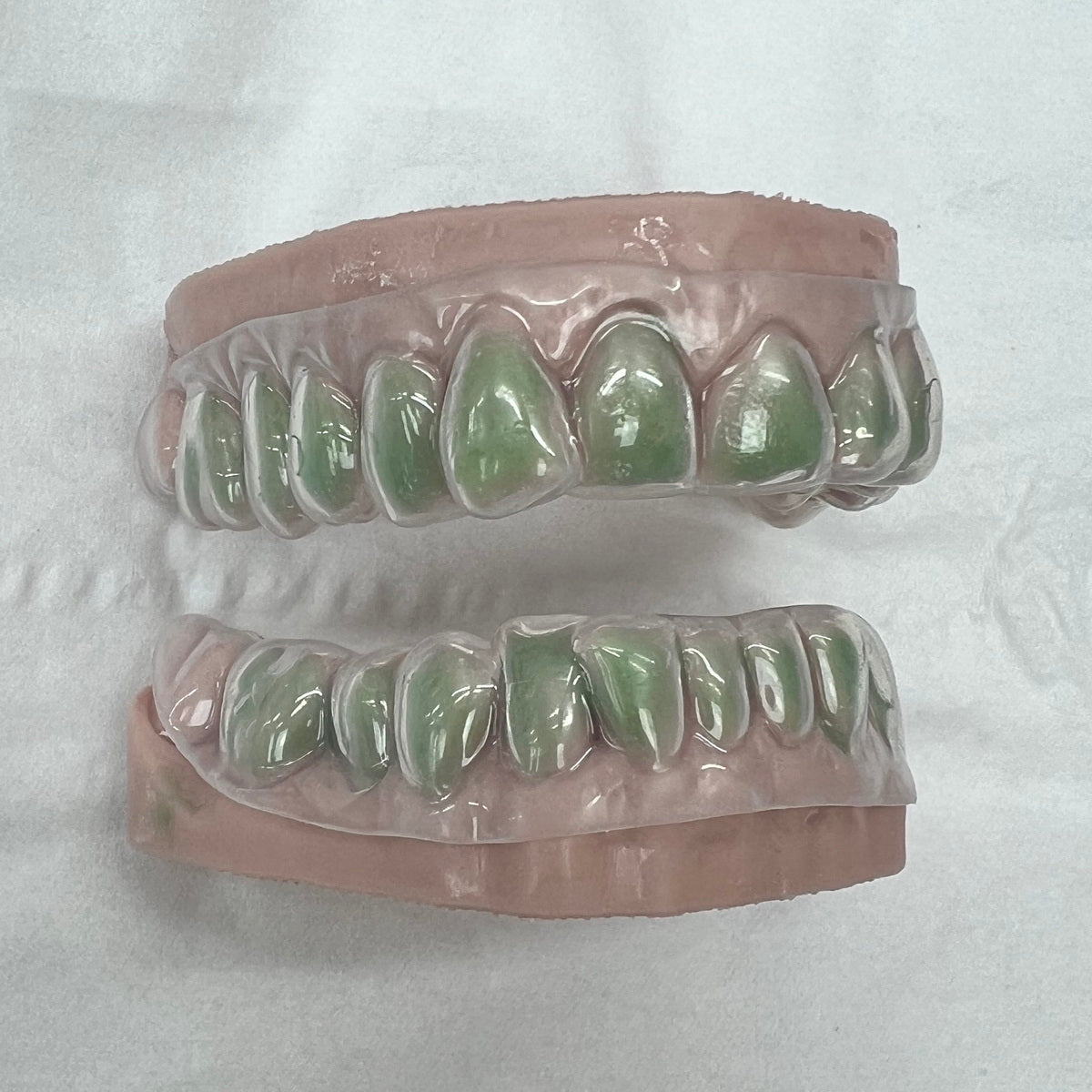Teeth Whitening Custom Mouth Trays