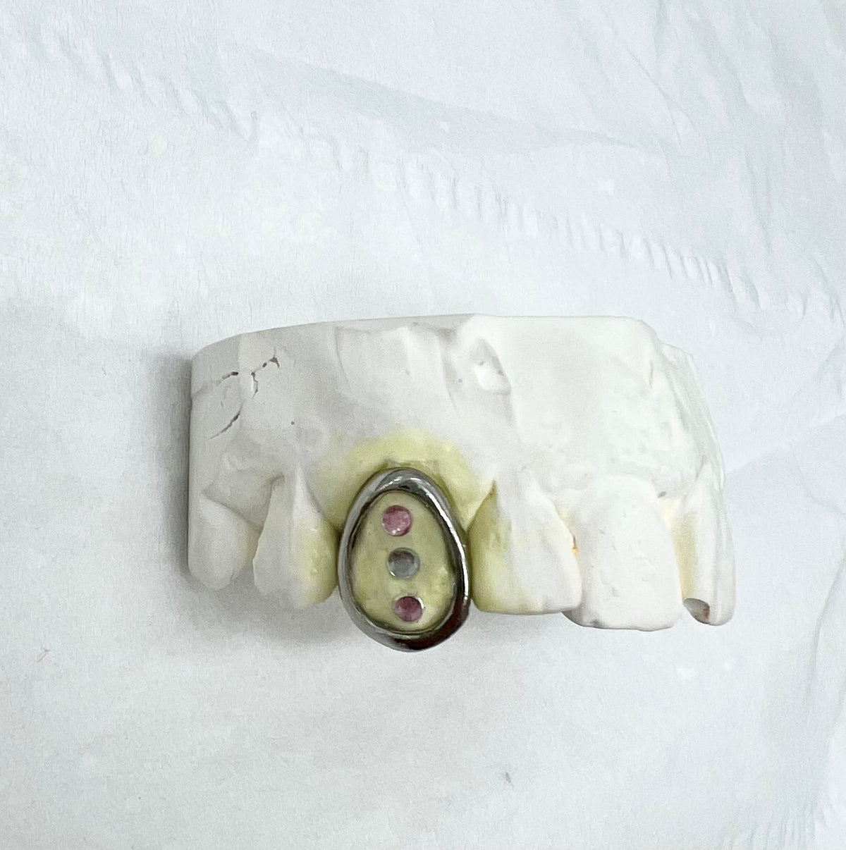 Acryl and Pearl Single Grillz