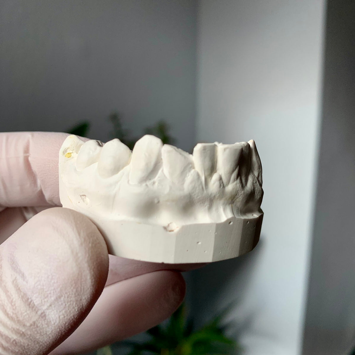 Broken Tooth Filler Custom Grillz