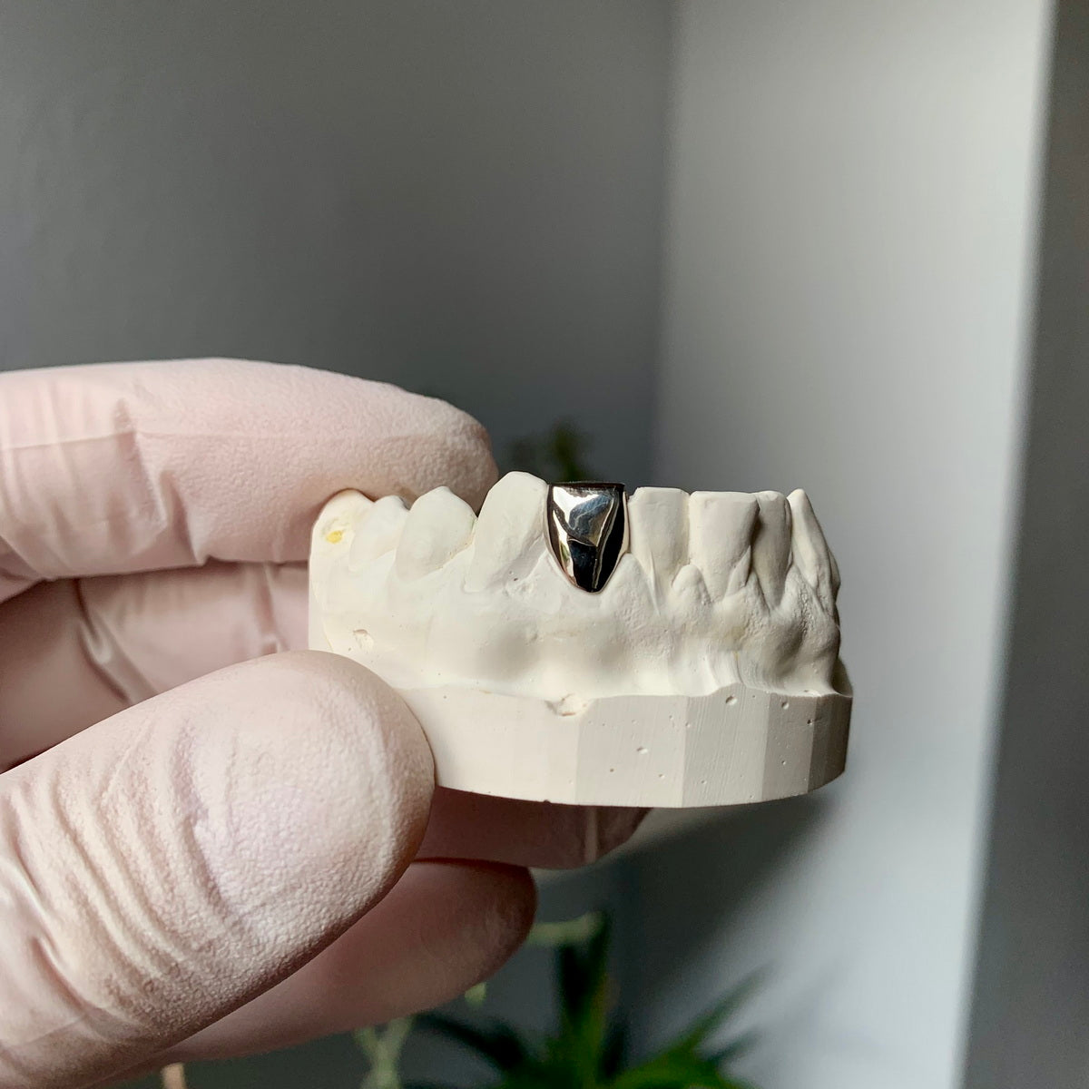 Broken Tooth Filler Custom Grillz