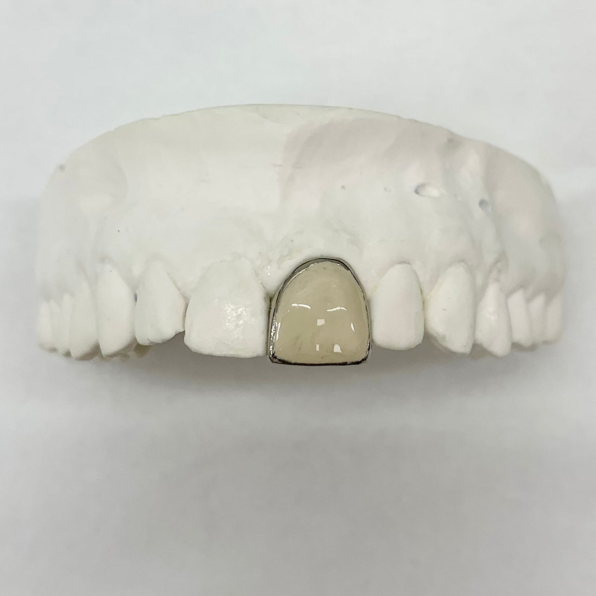 Fired Ceramic Custom Grillz