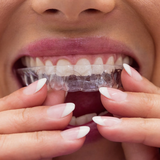 Teeth Whitening Custom Mouth Trays