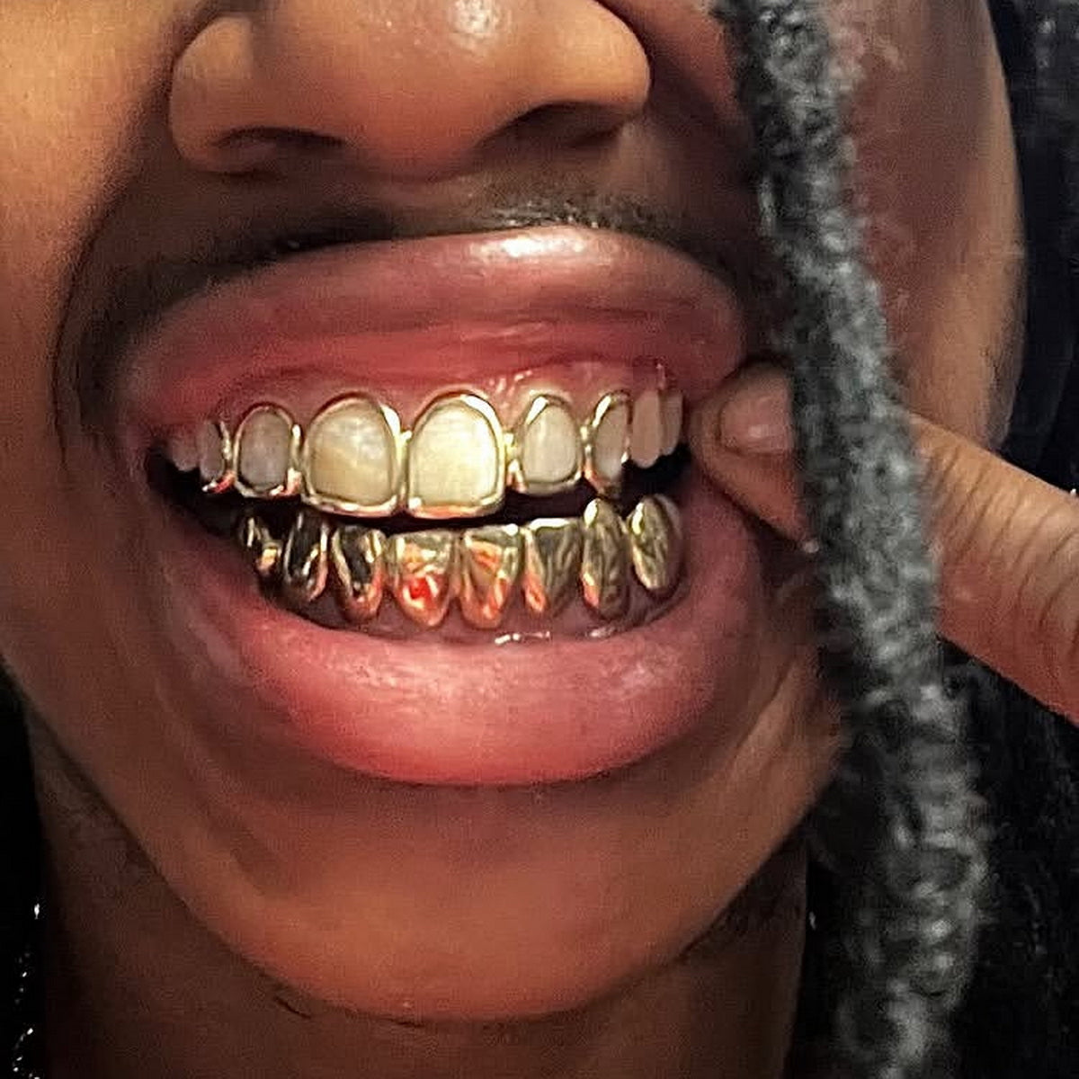 Luxury smile with Window 6 Set Custom Grillz