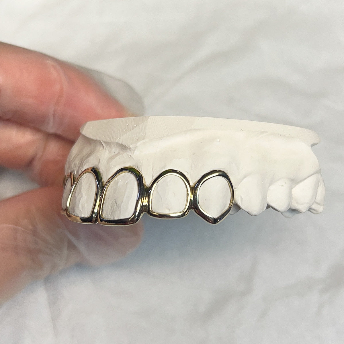 Upper Gold Window 6 Set Custom Grillz