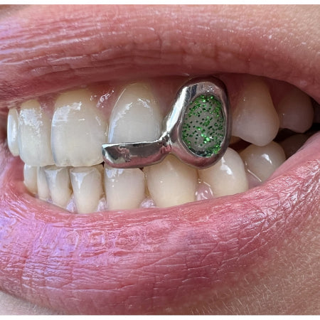 Window and Bar Grillz with Acryl