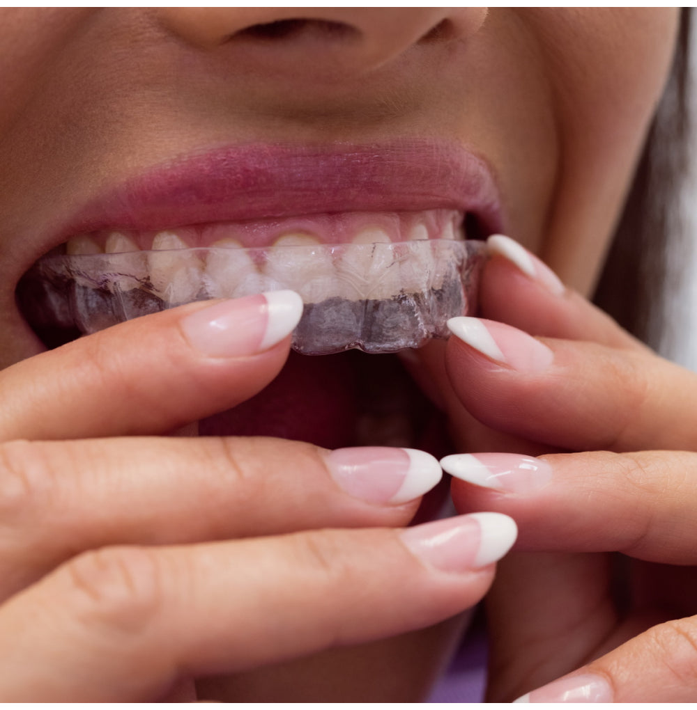 Custom-Made Essix Retainers