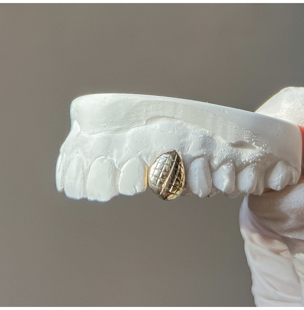 Custom Diamond Cut Grillz