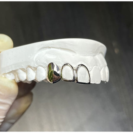 Custom Triple Caps Grillz
