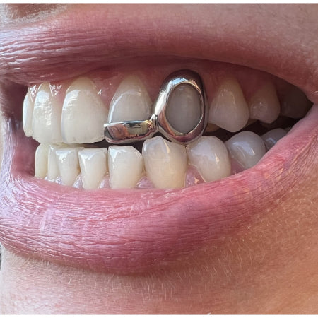 Window and Bar Grillz