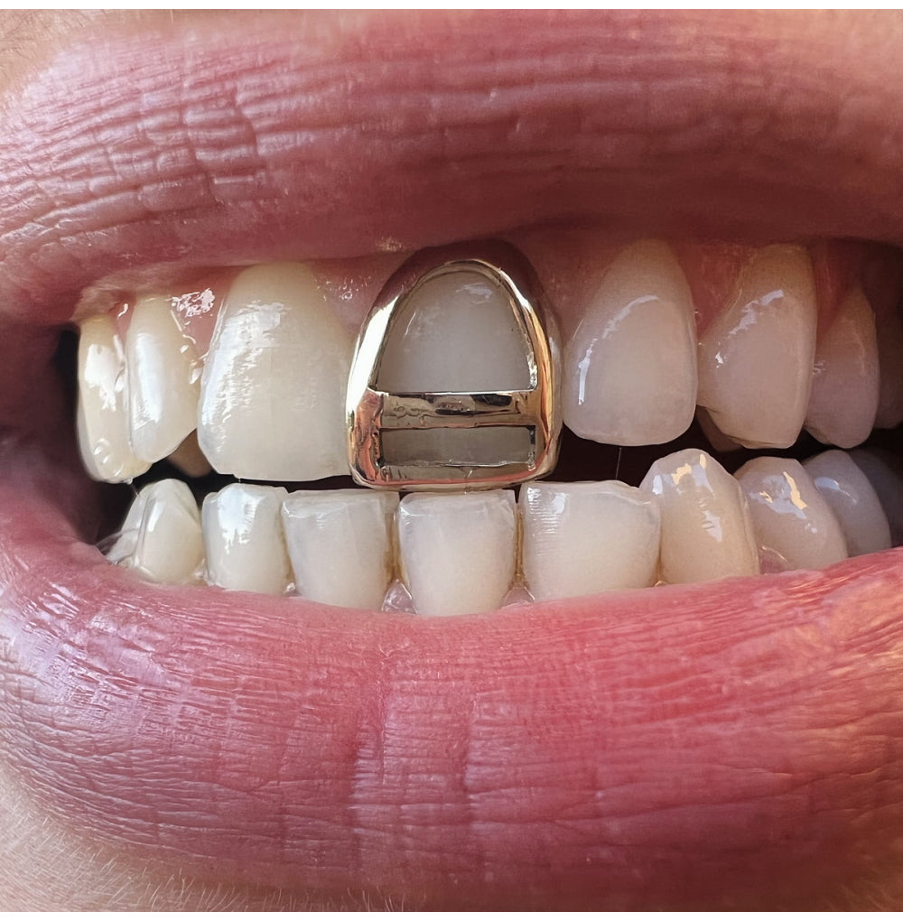 Custom Window Split Grillz