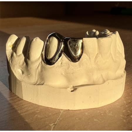 Tooth Filler 2 pieces Grillz